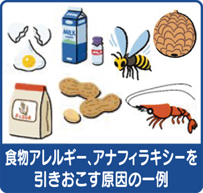 食物アレルギーとアナフィラキシー