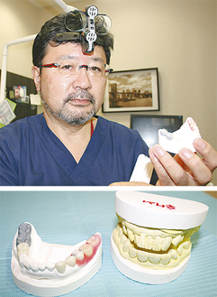 歯形を示す須田理事長（上）。治療終了後も目で確認できる歯形