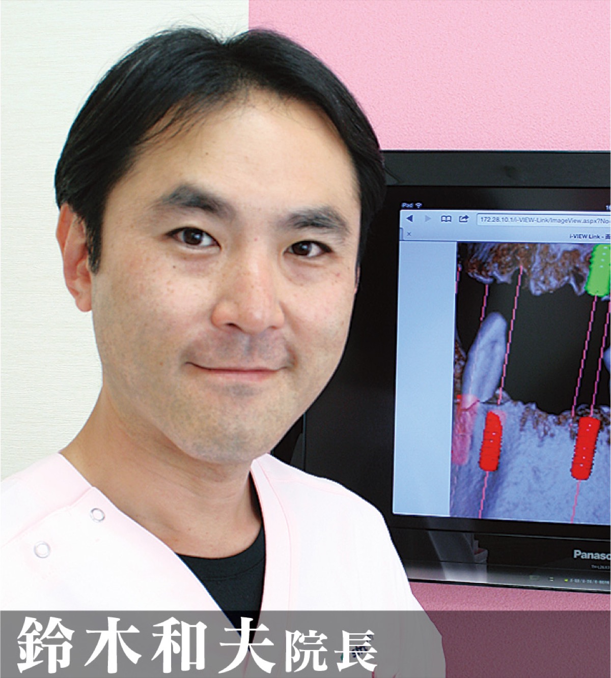 ｢インプラントのメリットは？｣ (写真1)