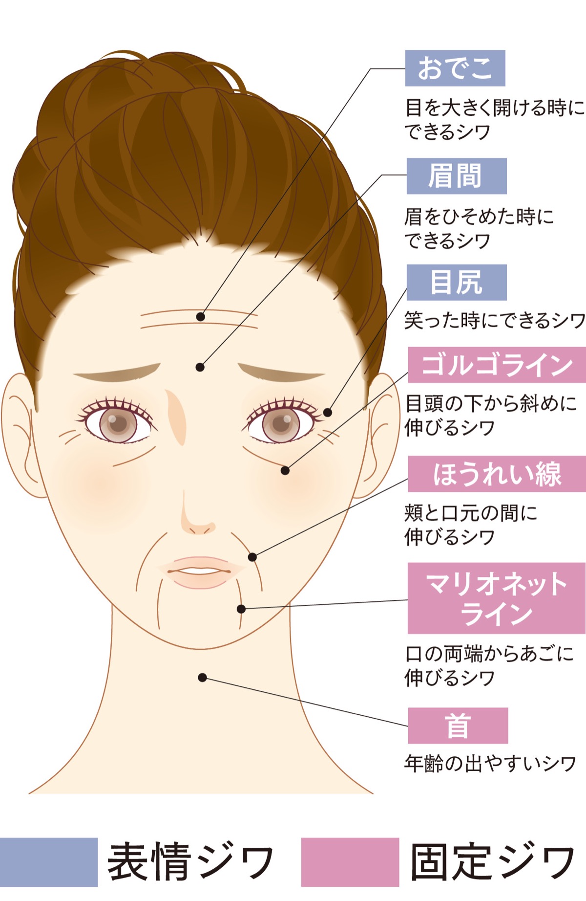 今やシワは注入のみで改善できる時代に ｑ ａ 気軽にシワ治療 人気の若返り注射 聖心美容クリニック 横浜院 旭区 タウンニュース