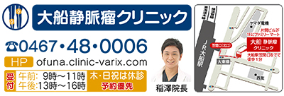 足の静脈瘤を日帰り手術