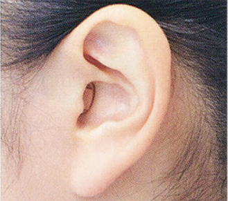 ▲小さく目立ちにくい「耳穴式」補聴器も人気