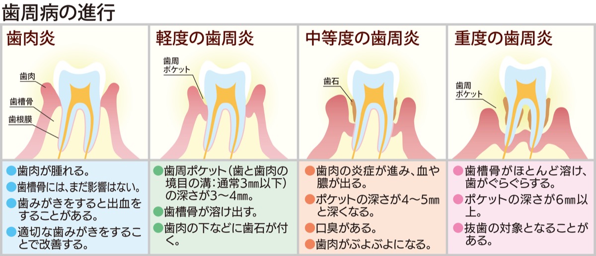 コロナ禍における歯と口の重要性 (写真3)