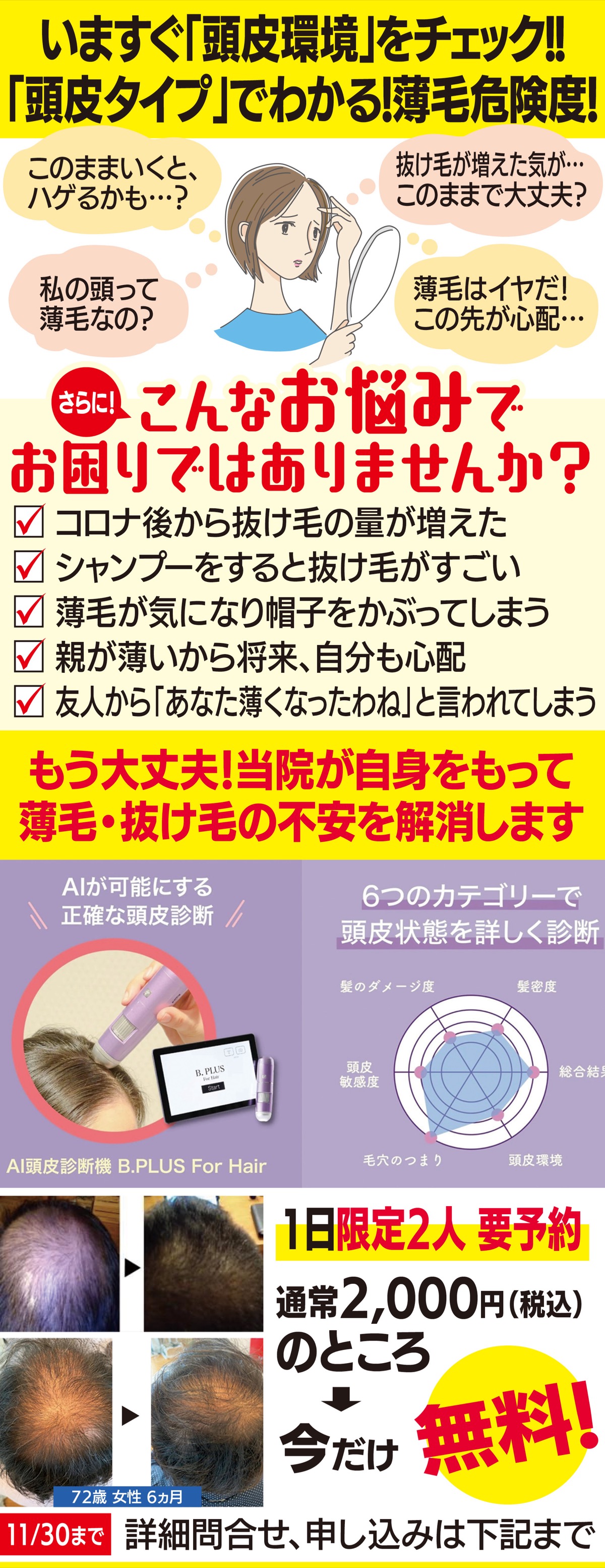 増える｢薄毛女性｣もしかして私も!?　　気になったら専門家に相談を (写真1)