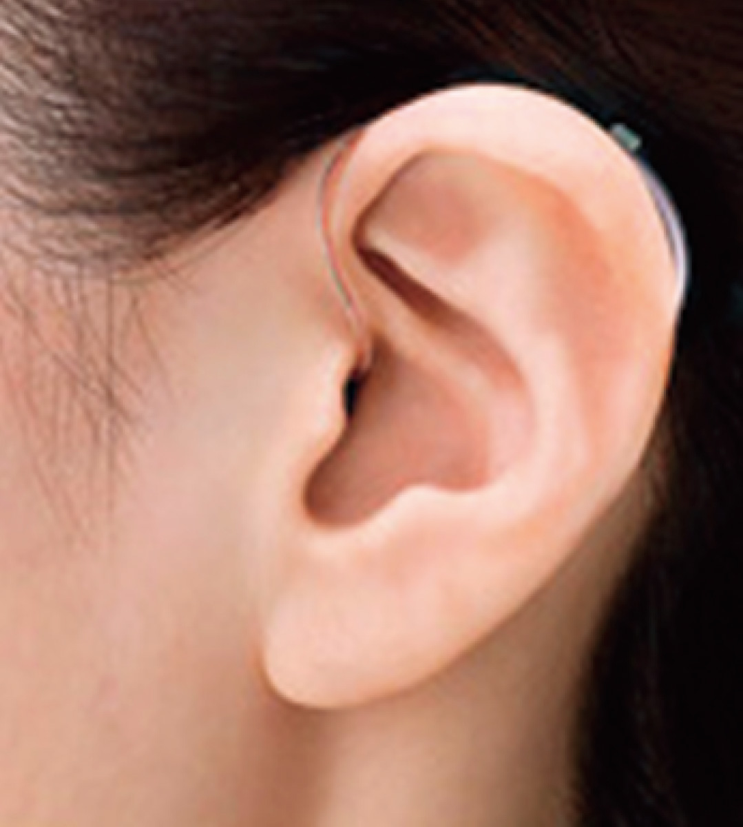 ”補聴器”無料相談