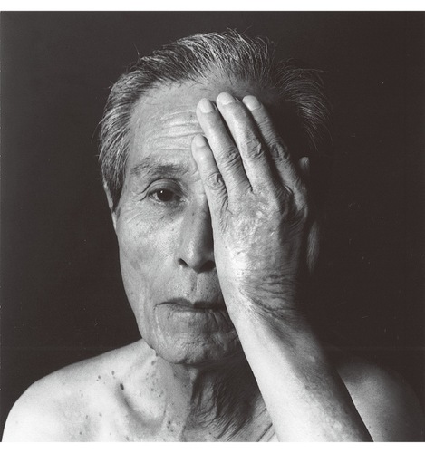 「ナガサキ」より『谷口稜曄』２００８年