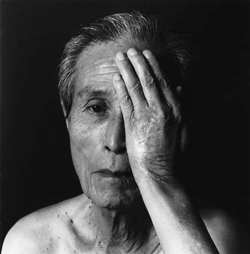 「ナガサキ」より『谷口稜曄』2008年