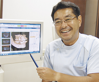 ＣＴ画像で立体的に歯の状態を説明
