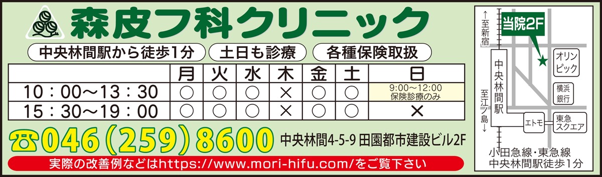 ｢切らない｣たるみ治療 (写真4)