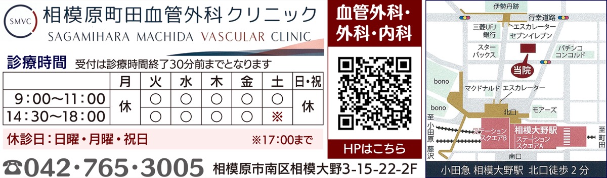 足のむくみやコブ下肢静脈瘤に悩んだら (写真2)
