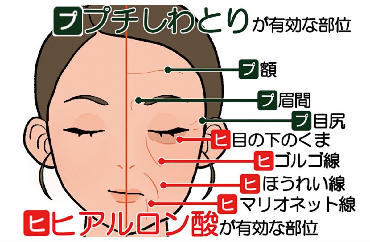 気になる「シワ」の対策を (写真2)
