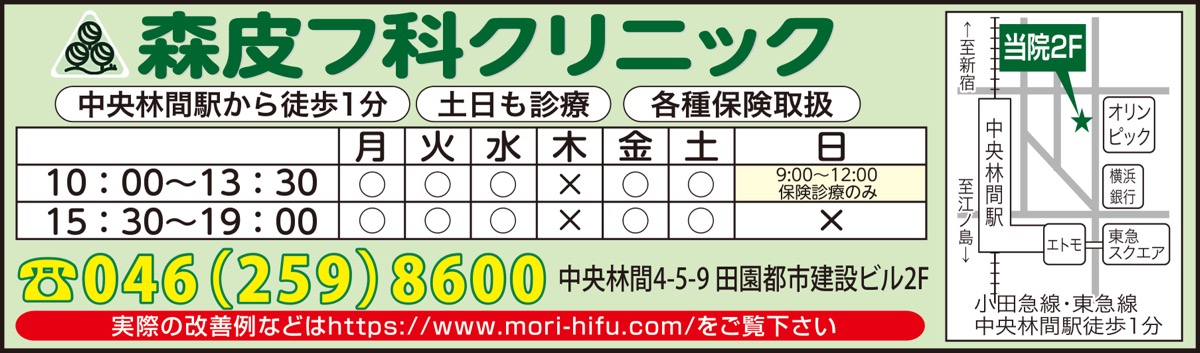 気になる「肝斑(かんぱん)」を改善 (写真3)
