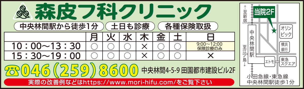 気になるシミ取りませんか (写真3)