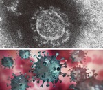 コロナウイルスの写真㊤とイメージ図㊦【国立感染症研究所提供】