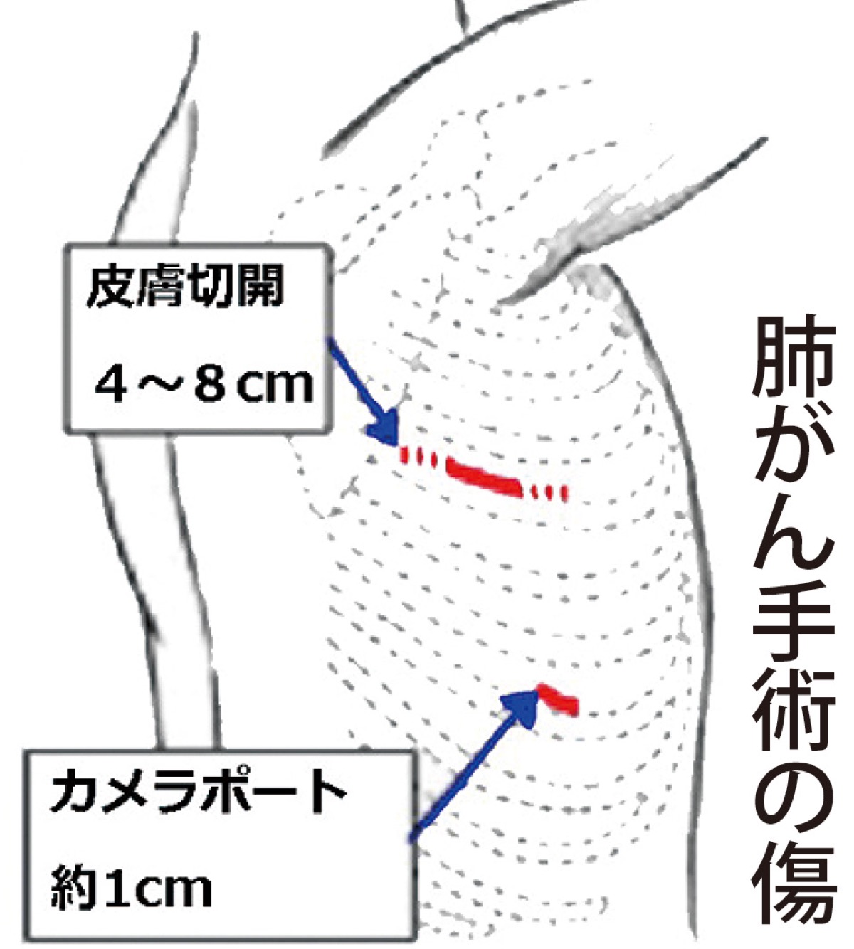 呼吸器疾患の対応に注力 (写真3)