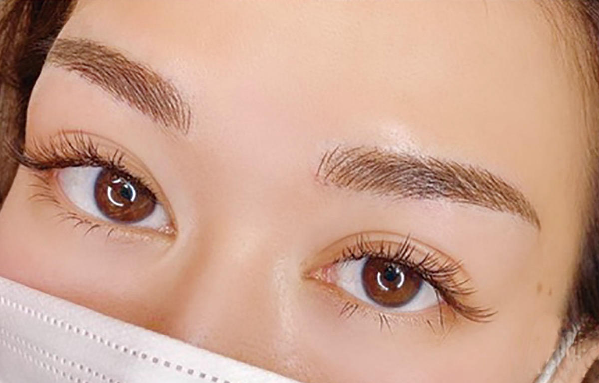 メディカルアートメイク施術後