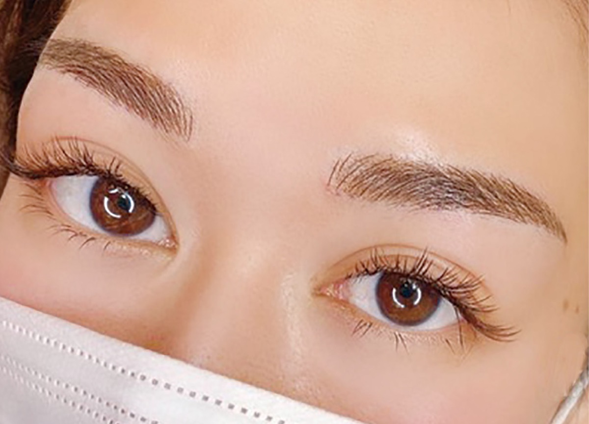 メディカルアートメイク施術後