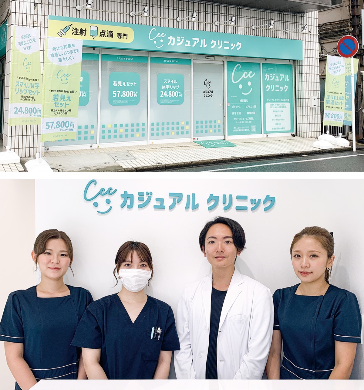 ボトックス注射が520円から