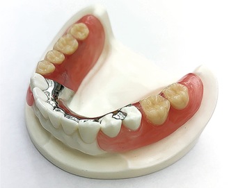 ひっかける金属が目立たない入れ歯（保険適用外）