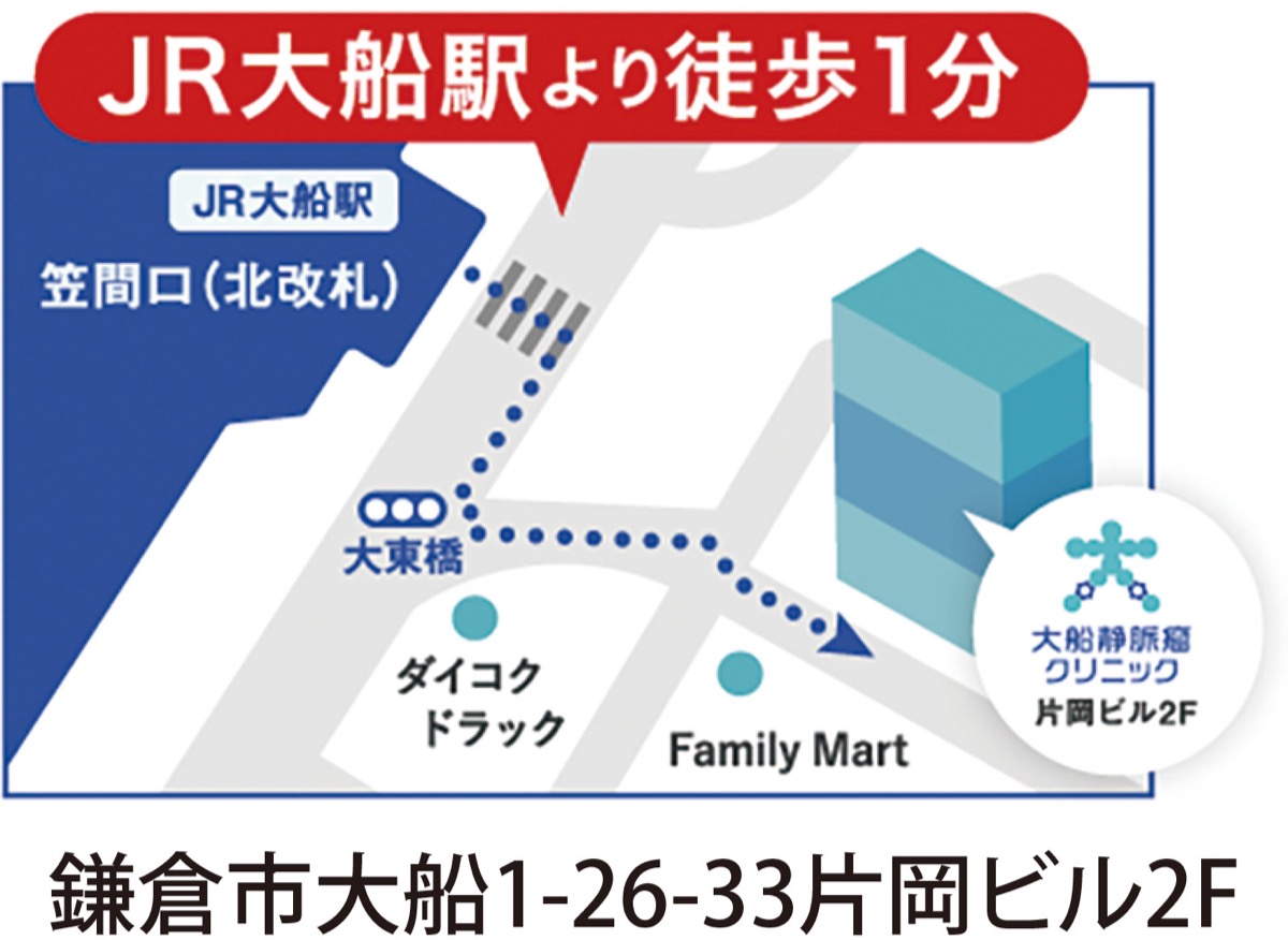 足の重だるさ、血管のふくらみ下肢静脈瘤かも (写真3)