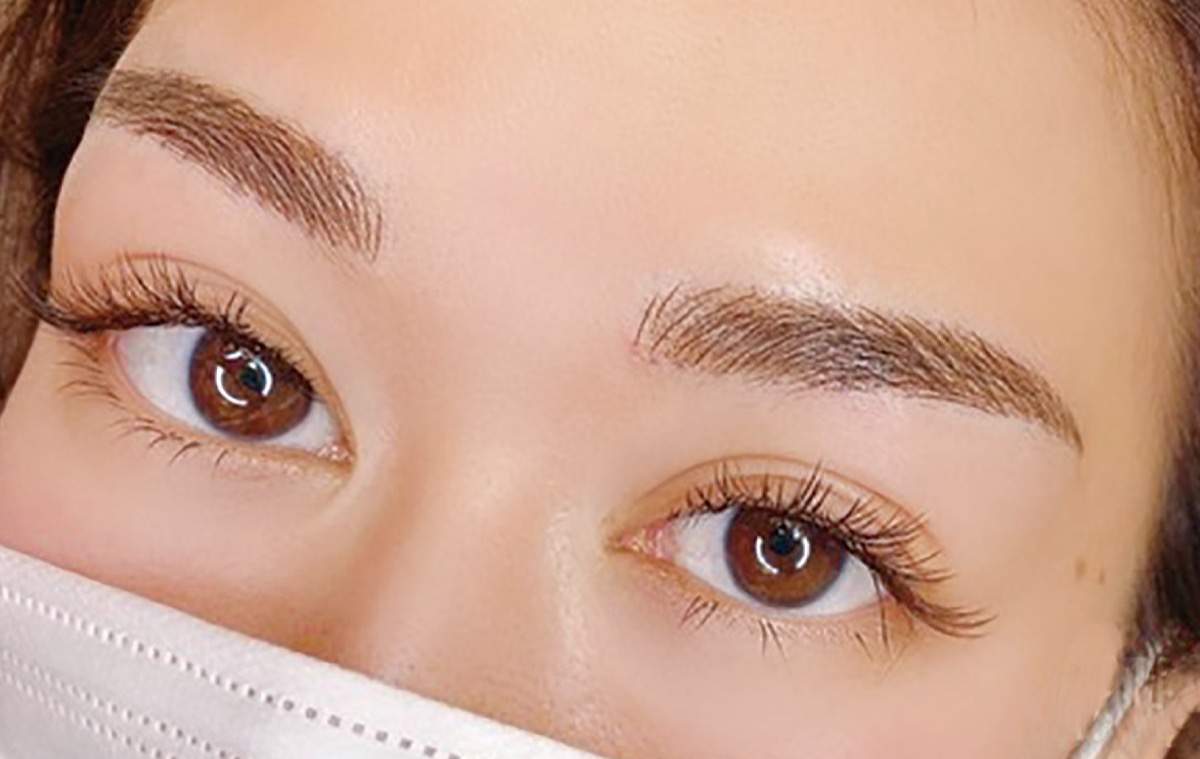 メディカルアートメイク施術後