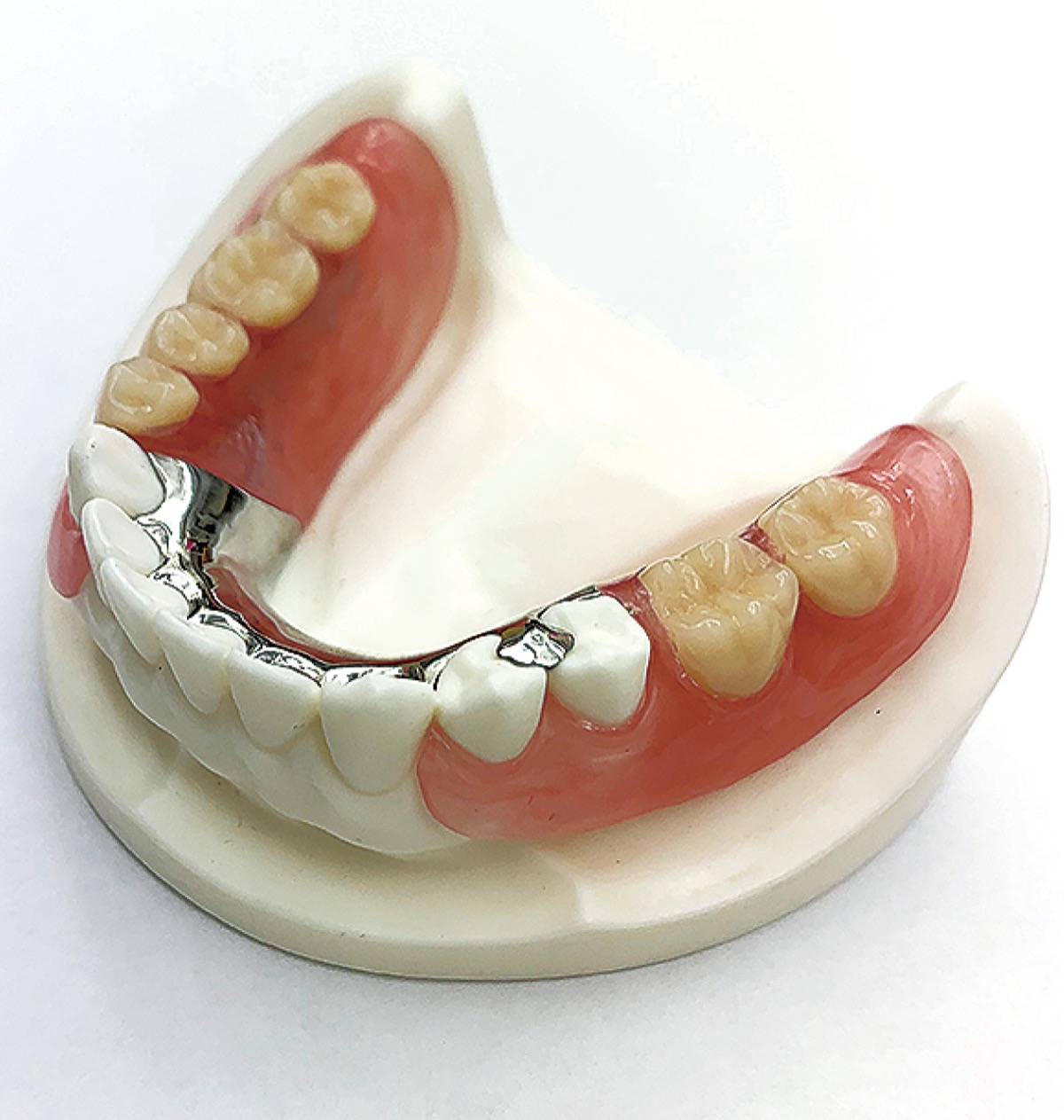 健康寿命を伸ばす 快適に噛める 入れ歯 入れ歯１１０番 自費入れ歯 健康保険入れ歯 医療法人社団 角理会 鵠沼アルカディア歯科 矯正歯科 寒川 タウンニュース