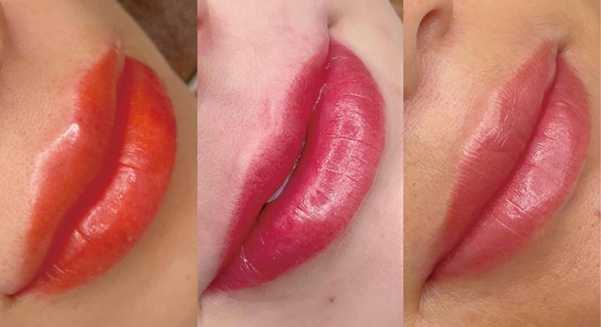 病とともに生きる人応援したい