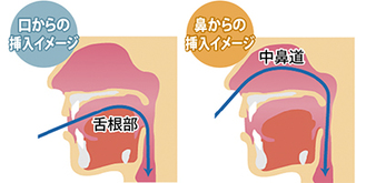 経鼻タイプの内視鏡（右）は、吐き気をもよおす舌根部に触れずに上部消化管検査ができる