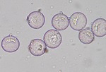 スギの花粉（光学顕微鏡により撮影・自然環境保全センター提供）