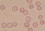 ヒノキの花粉（光学顕微鏡により撮影・自然環境保全センター提供）