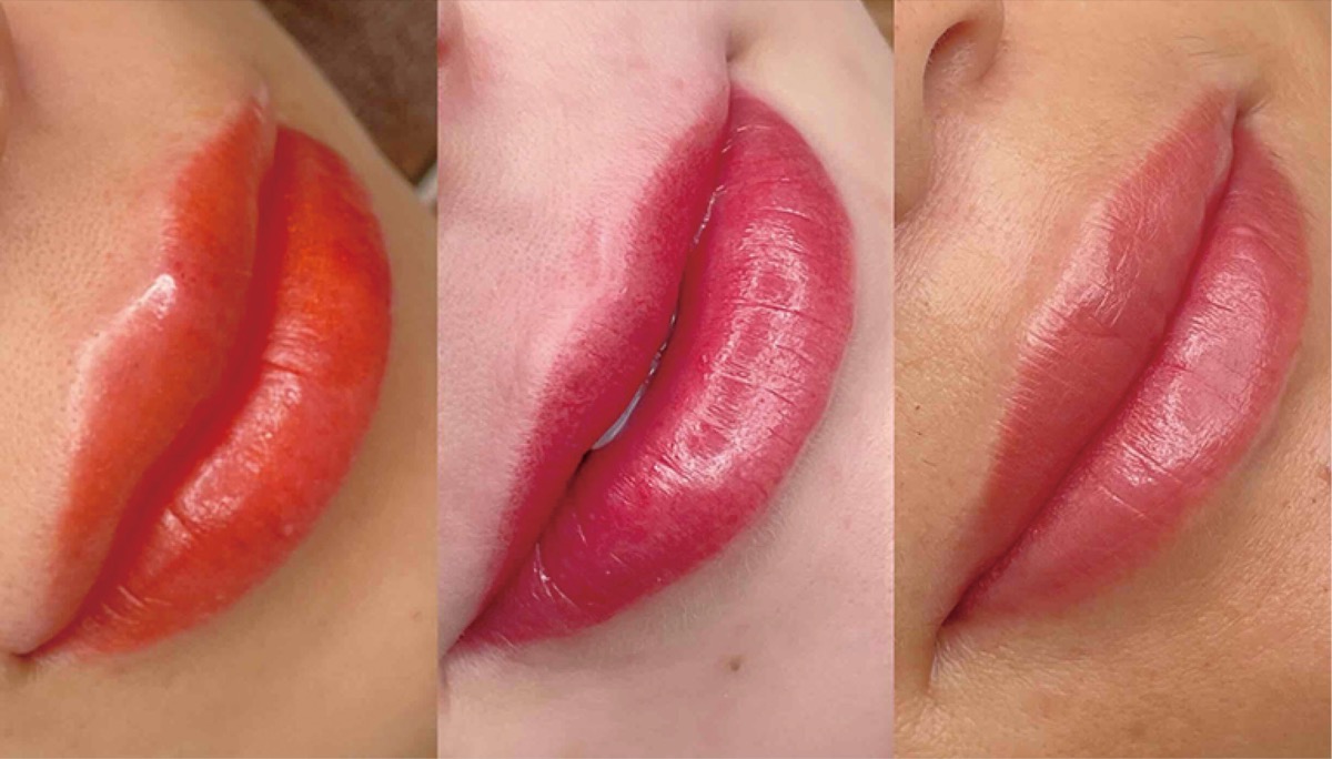 人気の唇は色など仕上がりを選べて理想の自分へ